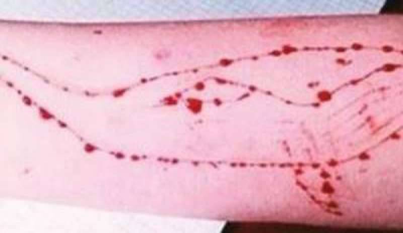 Blu Whale, salvata in extremis 13enne di Pescara. La confessione: “Facevo il gioco del suicidio”