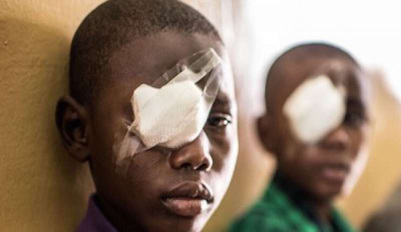 Etiopia, Cbm lancia la campagna “Ferma il contagio” contro il tracoma