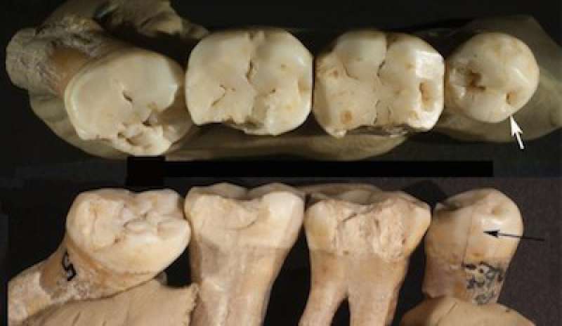 I primi dentisti furono gli uomini di Neanderthal: lo dicono i denti fossili