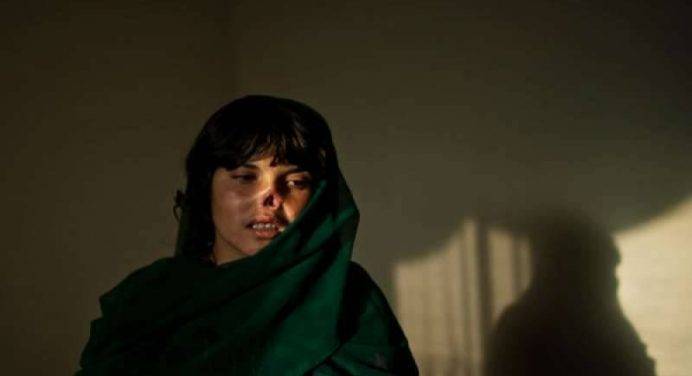 Kabul: litiga con la moglie e le taglia il naso