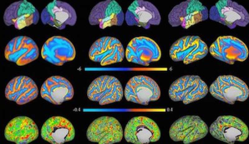 Online la prima mappa dello sviluppo del cervello umano