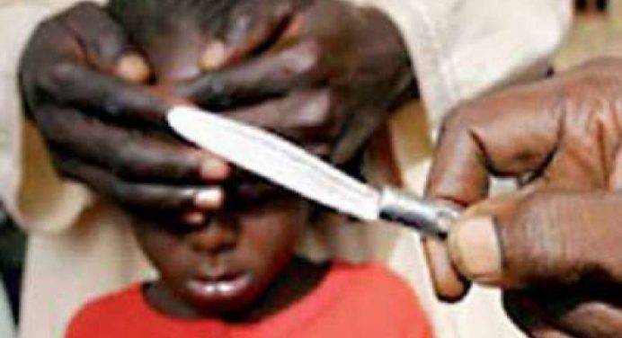 Praticava mutilazioni genitali: dottoressa rischia l’ergastolo in America