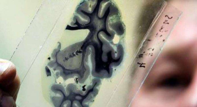 Una foto super-dettagliata apre nuovi scenari per la ricerca contro l’Alzheimer