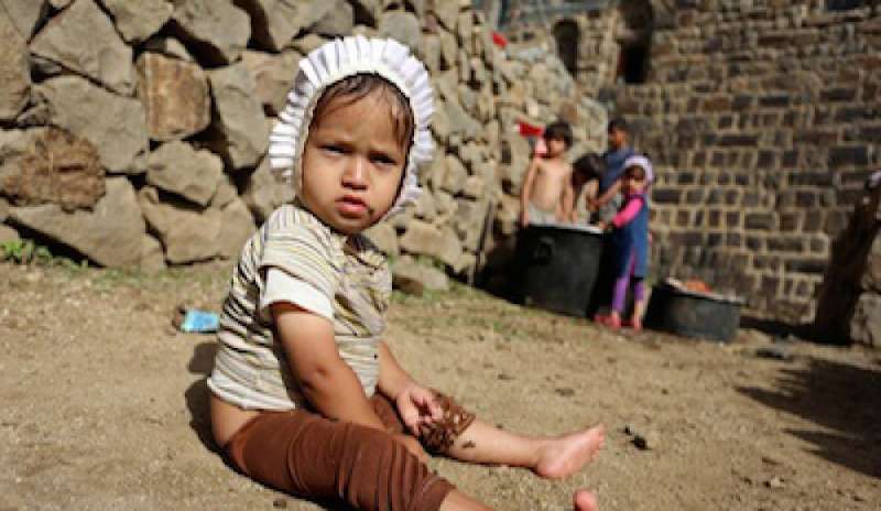 Yemen: Oms, 7 mila morti in 20 mesi e 2200 sospetti casi di colera