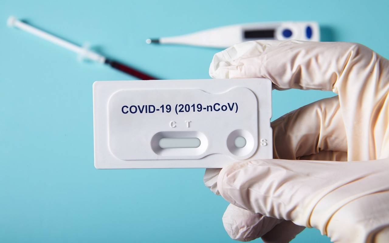 Federfarma: “I test rapidi per il coronavirus sono inattendibili”