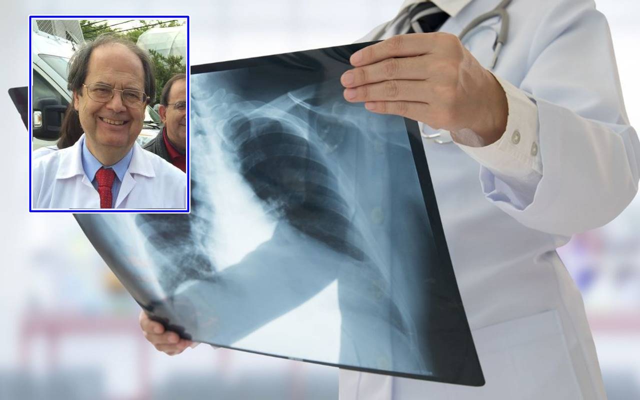 Prof. Morrone: “La tubercolosi? E’ la malattia degli ‘impoveriti'”