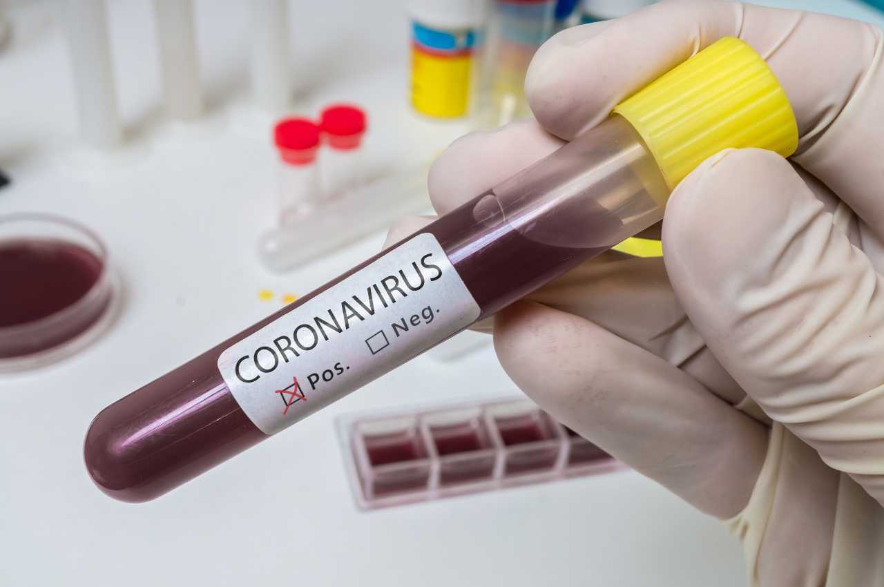 Coronavirus, al via la gara per i test sierologici: kit e caratteristiche