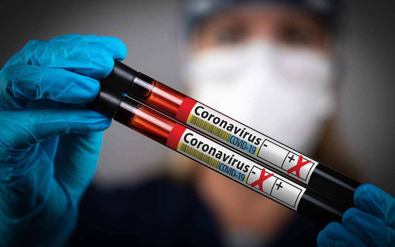 La Protezione Civile: “Oggi 415 vittime a causa del coronavirus”