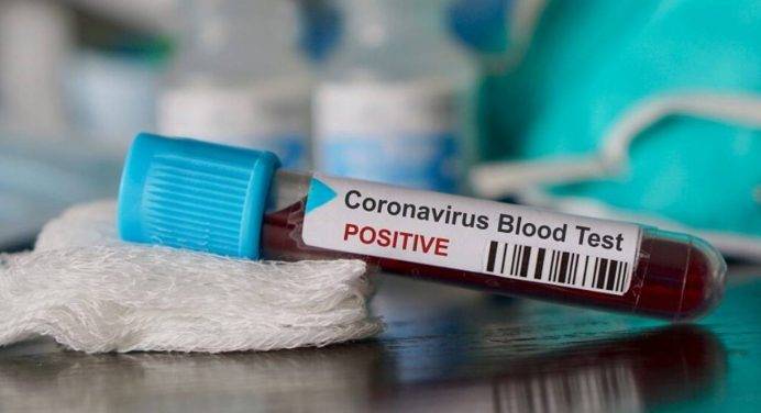 Coronavirus: ecco come la Gran Bretagna dà il via libera ai test sierologici della Roche