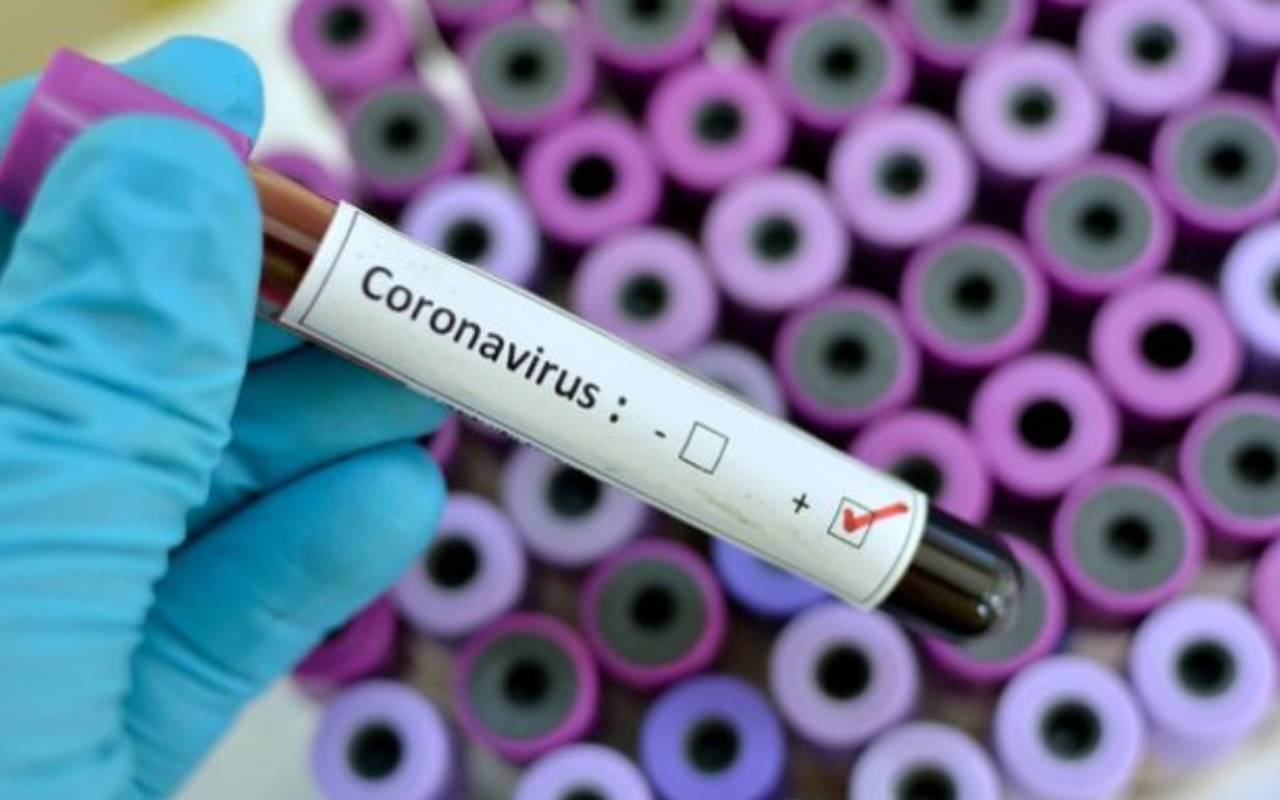 Coronavirus, nuovo aumento dei contagi: in 24 ore sono 845