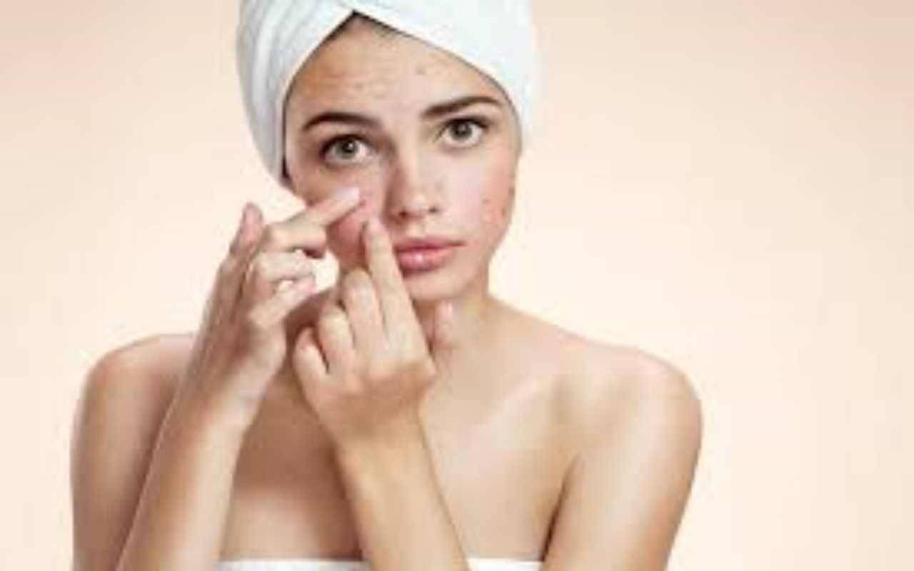 Combattere l’acne: una sfida che riguarda non soltanto le adolescenti