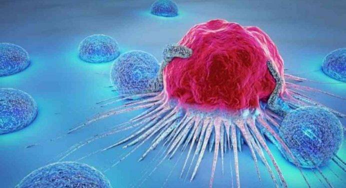 Tumore all’ovaio: l’instabilità dei cromosomi prevede il rischio di recidive