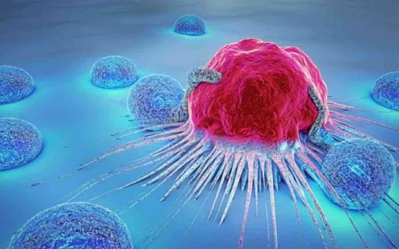 Tumore all’ovaio: l’instabilità dei cromosomi prevede il rischio di recidive