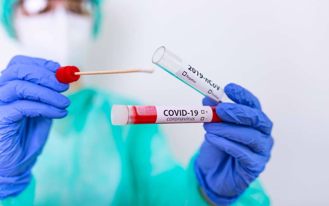Test anti-Covid abusivi: cosa è emerso dai controlli dei Nas