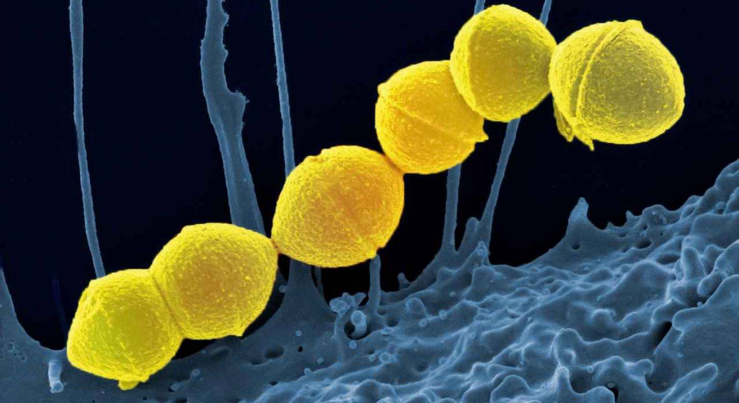 E’ boom di infezioni da Streptococco: le cause